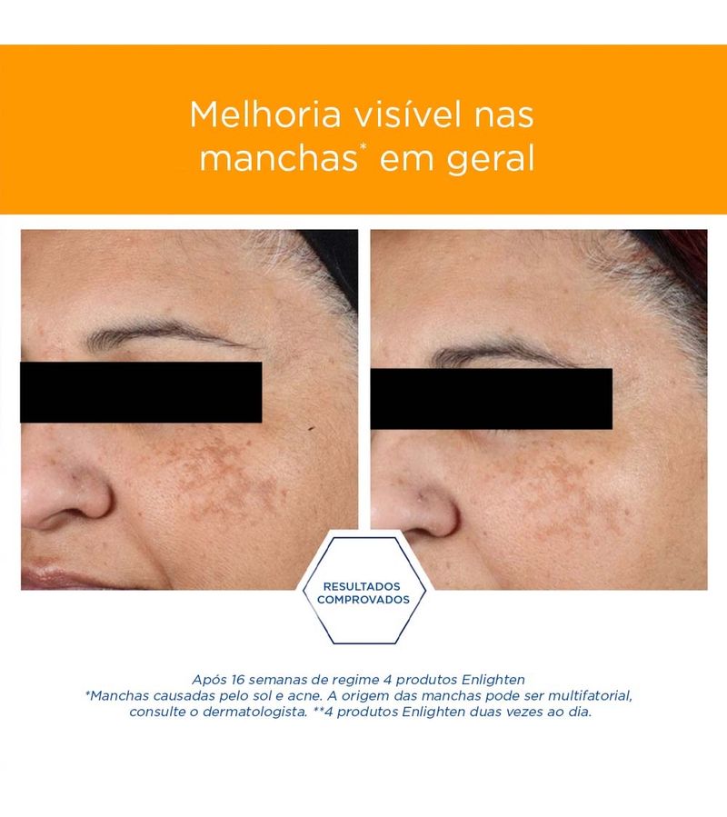 Creme-Uniformizador-Antioxidante-Facial-Neostrata®-Pigment-Controller--50ml