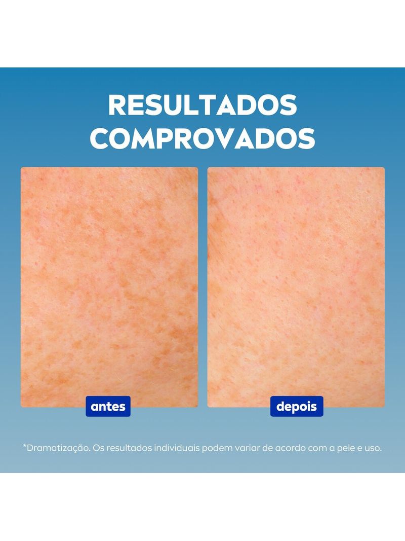 4005900813053-NIVEA_LUMINOUS_630_S_rum_Facial_Avan_ado_Antimarcas_Escurecidas_30ml-Face-NIVEA--4-.jpg