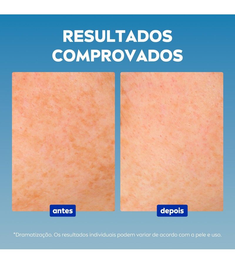 4005900813053-NIVEA_LUMINOUS_630_S_rum_Facial_Avan_ado_Antimarcas_Escurecidas_30ml-Face-NIVEA--4-.jpg