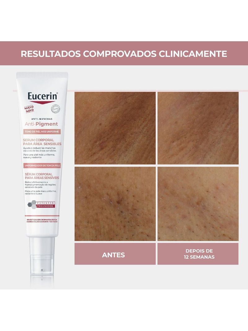 4006000014401-Eucerin_Anti_Pigment_S_rum_Corporal_reas_Sens_veis_75ml-Body-Eucerin_--9-.jpg